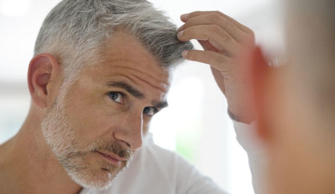 implantes capilares en España - pelo gris
