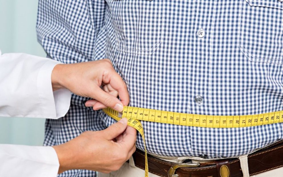 reducción de estómago en España - paciente masculino