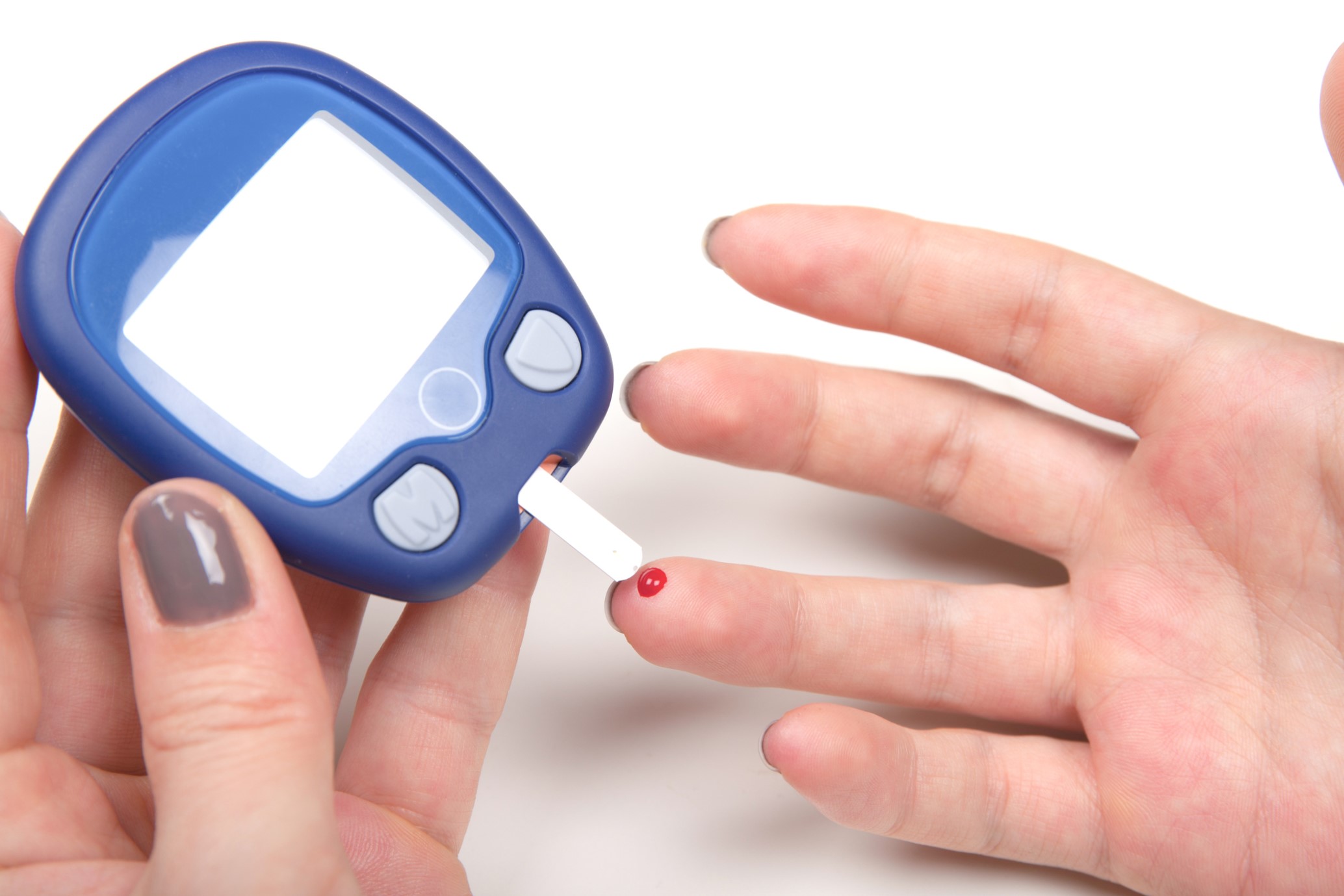 cirugía bariátrica para diabetes tipo 2 - medición de azúcar