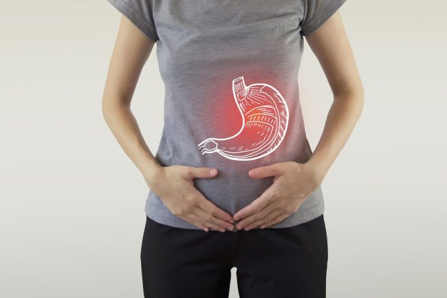 reducción de estómago con cirugía en España - estómago