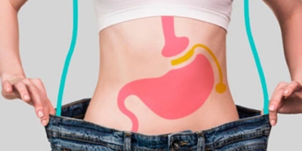 ciurgía Bariátrica en España - mejorar