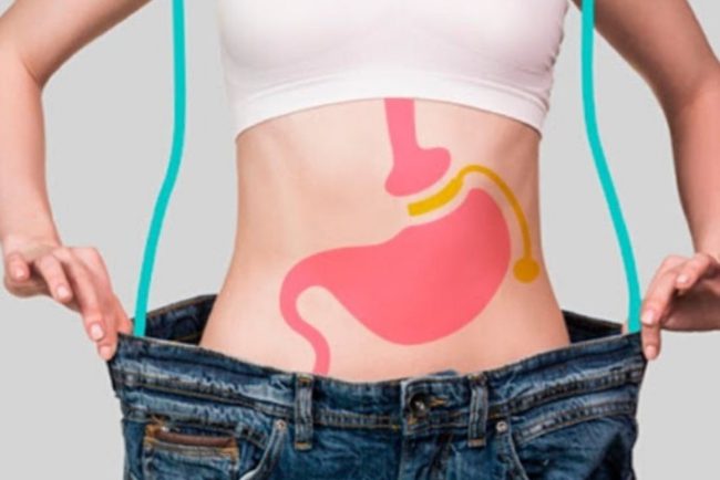 ciurgía Bariátrica en España - mejorar