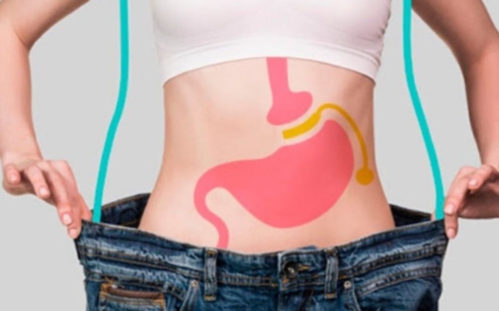 ciurgía Bariátrica en España - mejorar