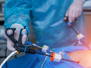 cirugía bariátrica en Colombia - intervención