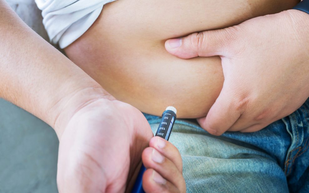 Cirugía bariátrica para diabetes tipo dos -Insulina