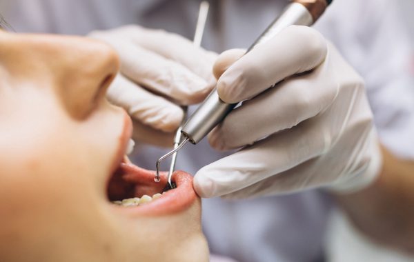 Turismo de salud - estética dental