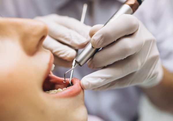 Turismo de salud - estética dental