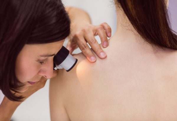 dermatología - revisión en la piel