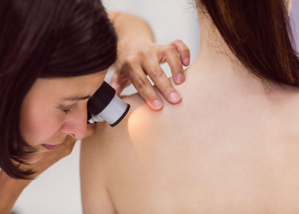 dermatología - revisión en la piel