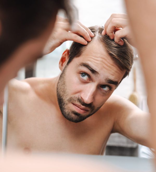 implante capilar - hombre revisando su pelo