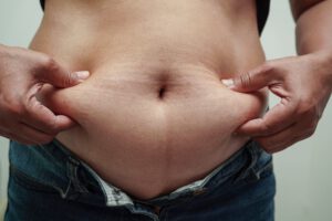 Cirugía bariátrica en Turquía -Obesidad