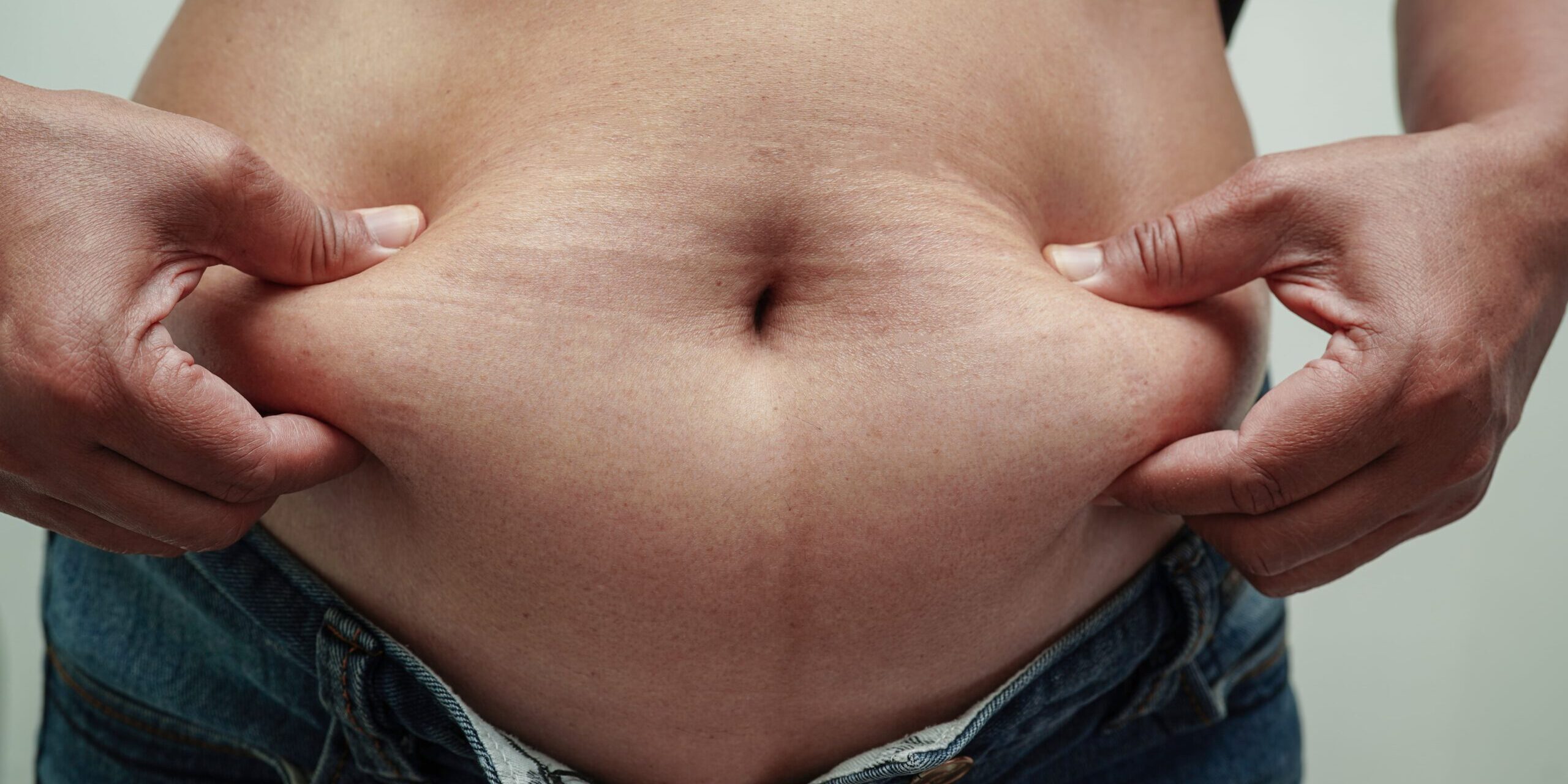 Cirugía bariátrica en Turquía -Obesidad