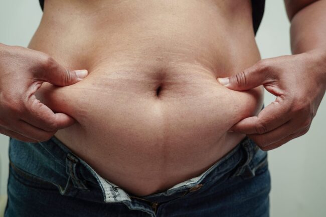 Cirugía bariátrica en Turquía -Obesidad