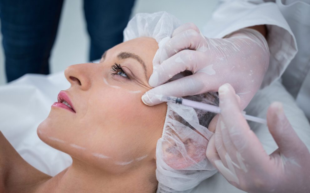 blefaroplastia en Colombia -Estética