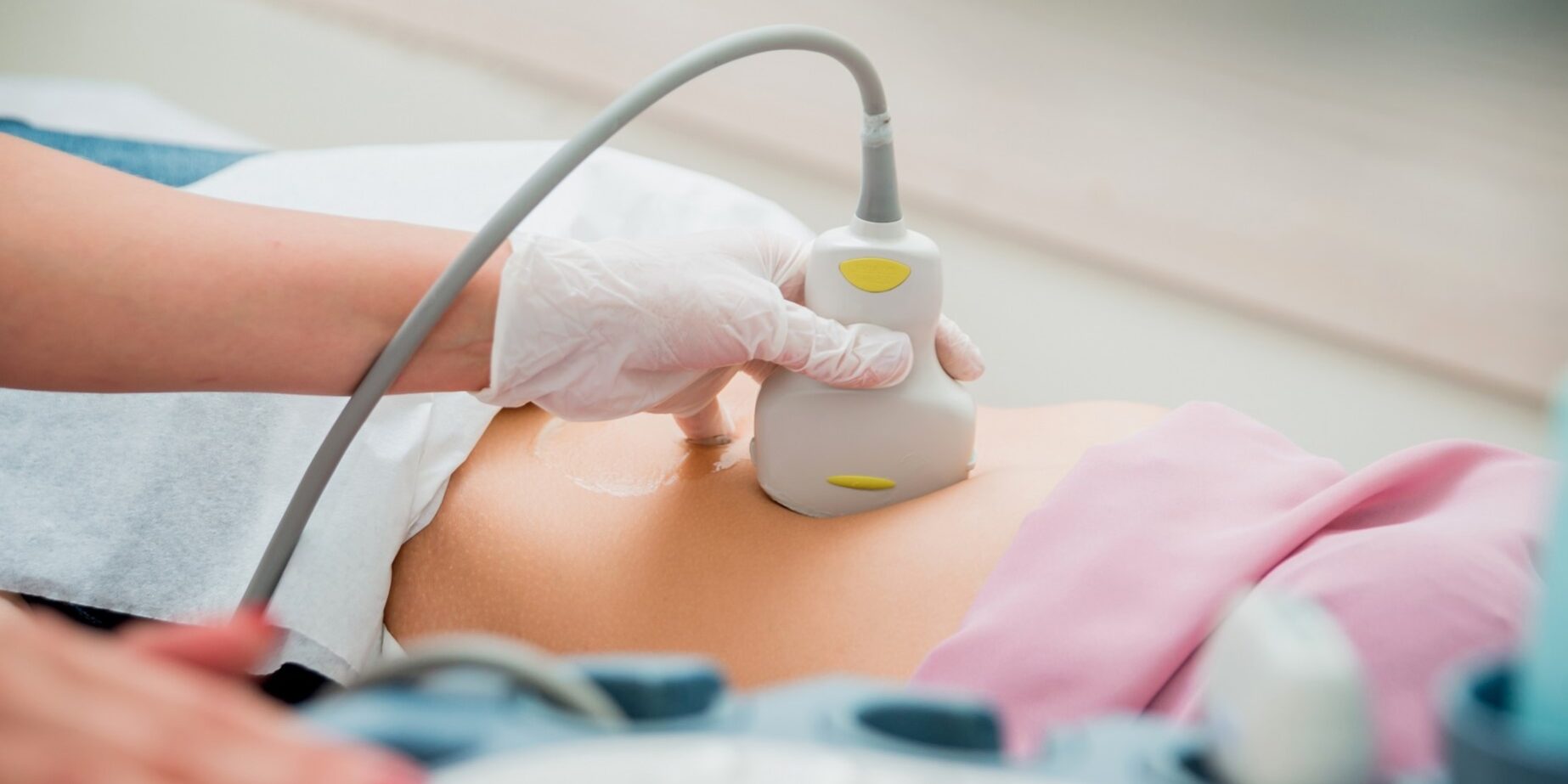 IVF con semen de donante no anónimo - eco