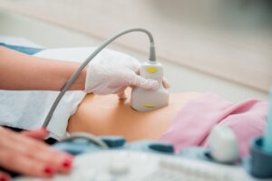 IVF con semen de donante no anónimo - eco