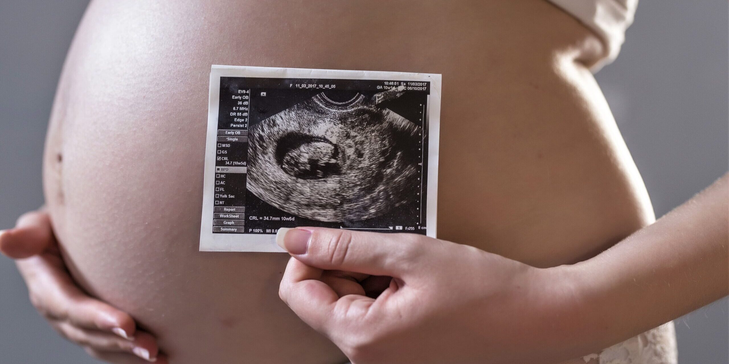 surrogacy in mexico - ultrasound