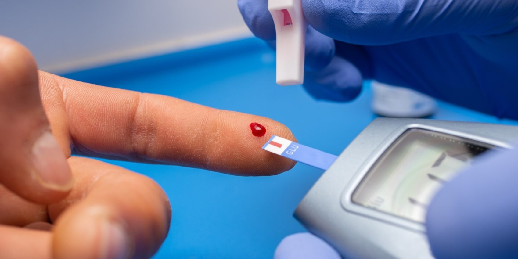 cirugía para diabetes tipo 2 en España – sangre cirugía para diabetes tipo 2 en España - sangre