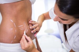 cirugía estetica en colombia - abdomen