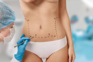 Cirugía estética en Colombia - Abdomen