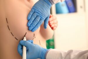 Aumento de pecho en Colombia - Guantes