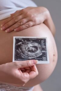 Gestación subrogada en México - Ecografía