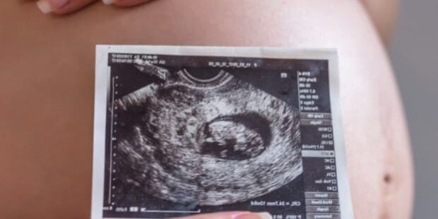 Gestación subrogada en México - Ecografía