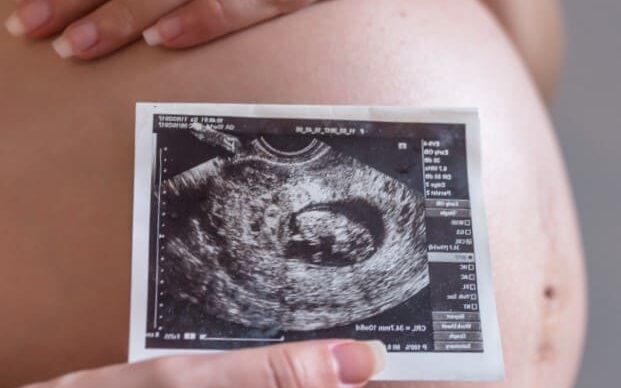 Gestación subrogada en México - Ecografía