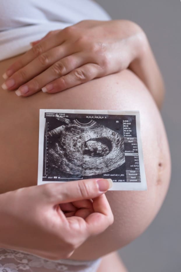 Gestación subrogada en México - Ecografía