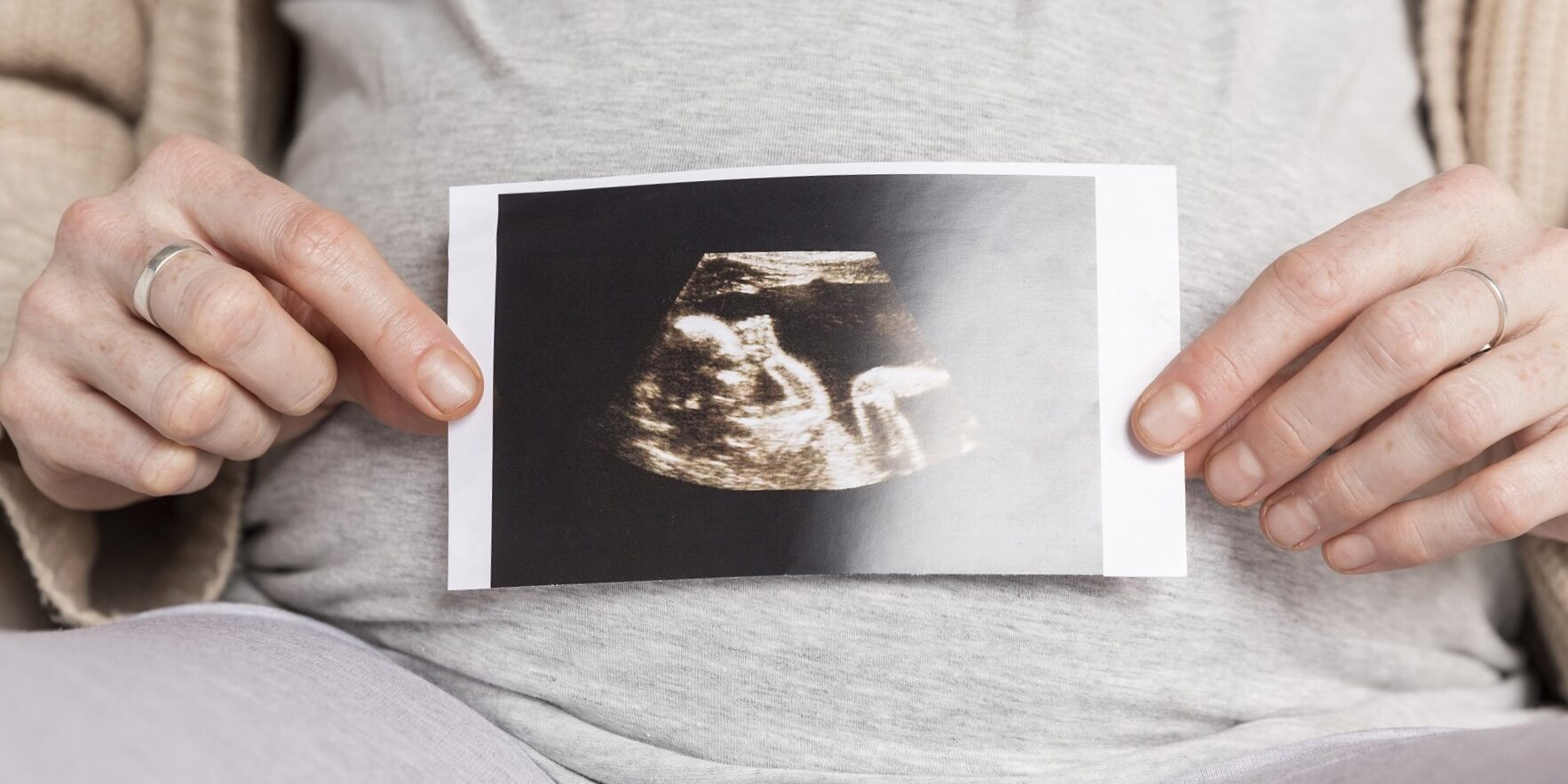 Surrogate pregnancy in the US - photo