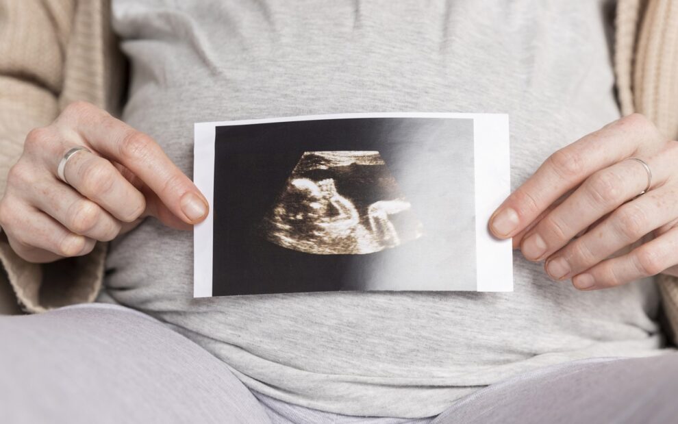 Surrogate pregnancy in the US – photo Surrogate pregnancy in the US - photo