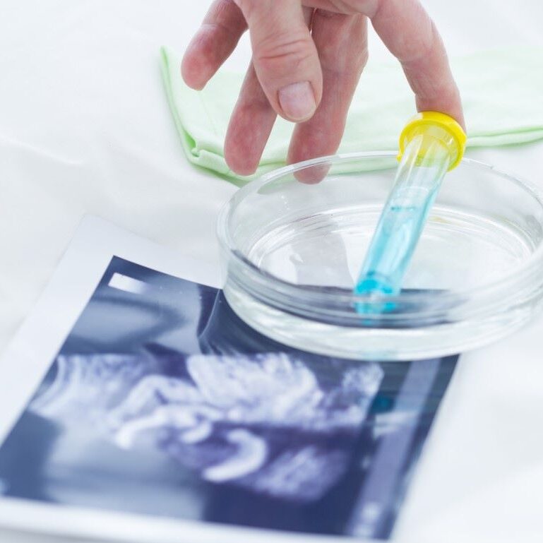 Elegir donante de semen - Eco