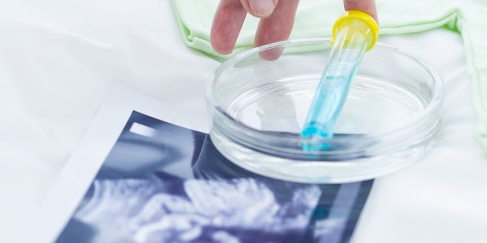 Elegir donante de semen – Eco Elegir donante de semen - Eco