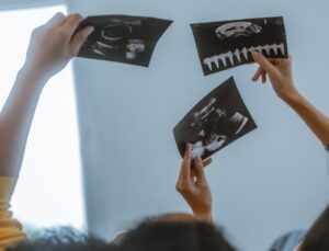 Adopción de embriones con selección de sexo del bebé - Mujeres